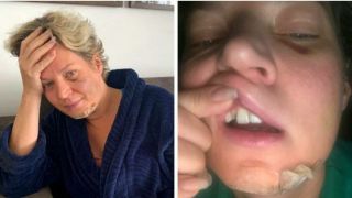 Com fraturas no rosto e no corpo, deputada federal Joice Hasselmann pede investigação à Polícia Legislativa