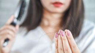 Alopecia: conheça a doença que causa perda de cabelo