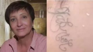 Jornalista da Globo oferece ajuda à jovem que teve rosto tatuado por ex