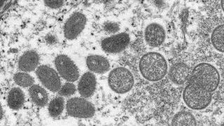 Rio Grande do Sul tem dois casos confirmados e seis suspeitos de varíola dos macacos