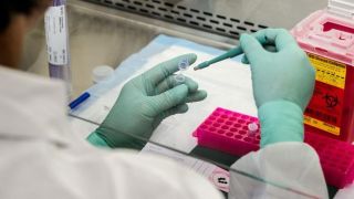 Teste de vacina experimental contra HIV é suspenso por ineficácia