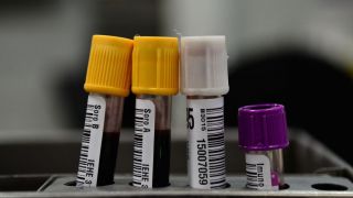 Hemorio inicia testes com plasma sanguíneo em pacientes com covid-19