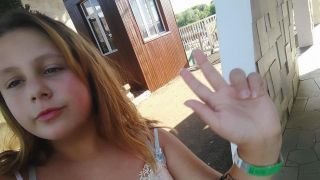 Atualização: Morre menina de 12 anos ferida durante incêndio com lareira improvisada em Lagoa Vermelha