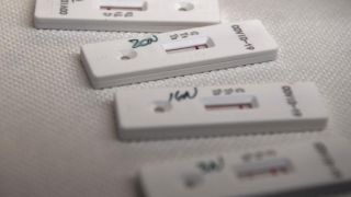 Ministério da Saúde obriga todos laboratórios a notificar testes de Covid-19